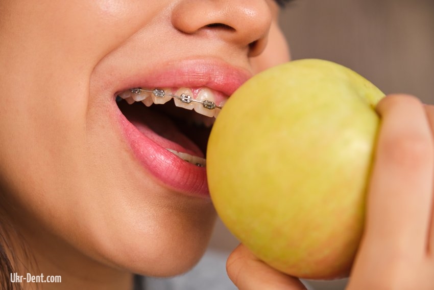 The Impact of Nutrition on Dental Health